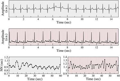 Heart Rate Fragmentation: A New Approach to the Analysis of Cardiac Interbeat Interval Dynamics